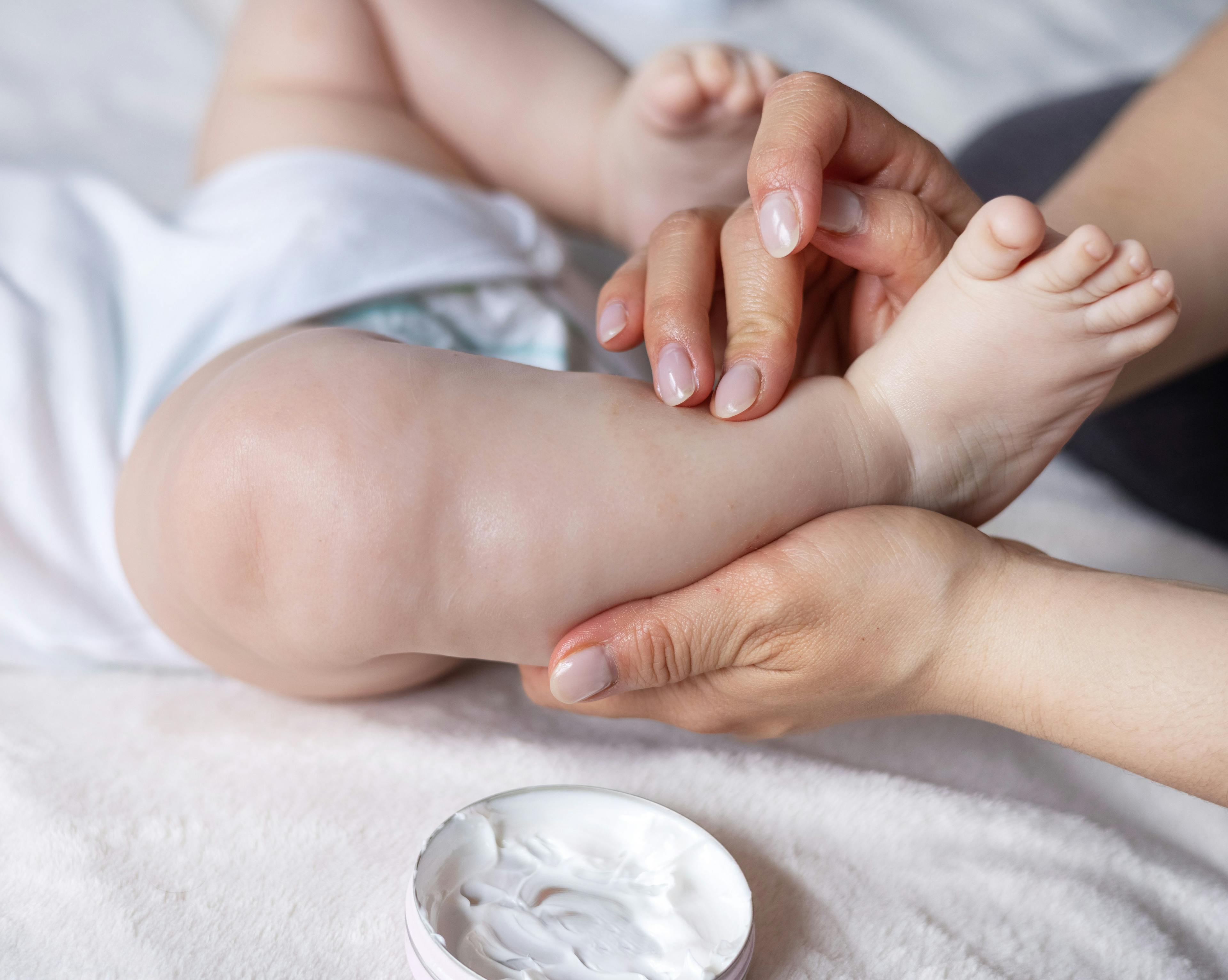 Strategies and tips to tackle dry skin in children | Image Credit: © Alexandra - © Alexandra- stock.adobe.com.