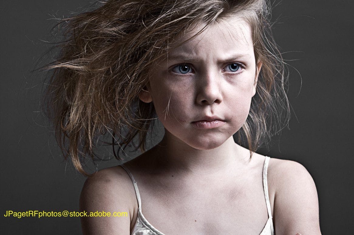 image of child showing neglect