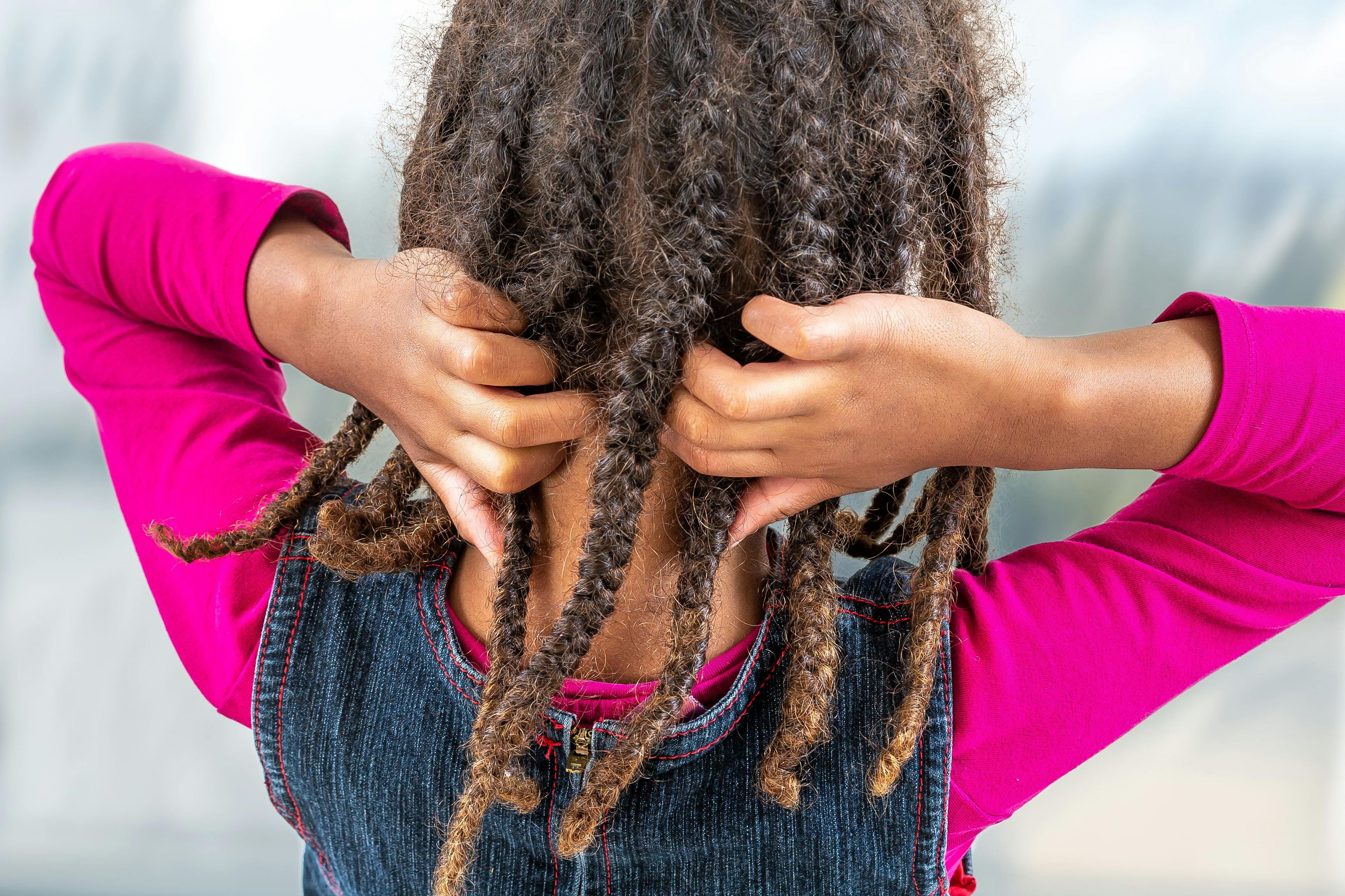 AAP updates guidelines for head lice