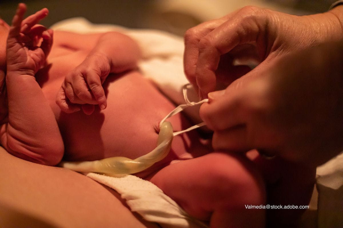 Does the umbilical cord management strategy used in preterm infants impact mortality?