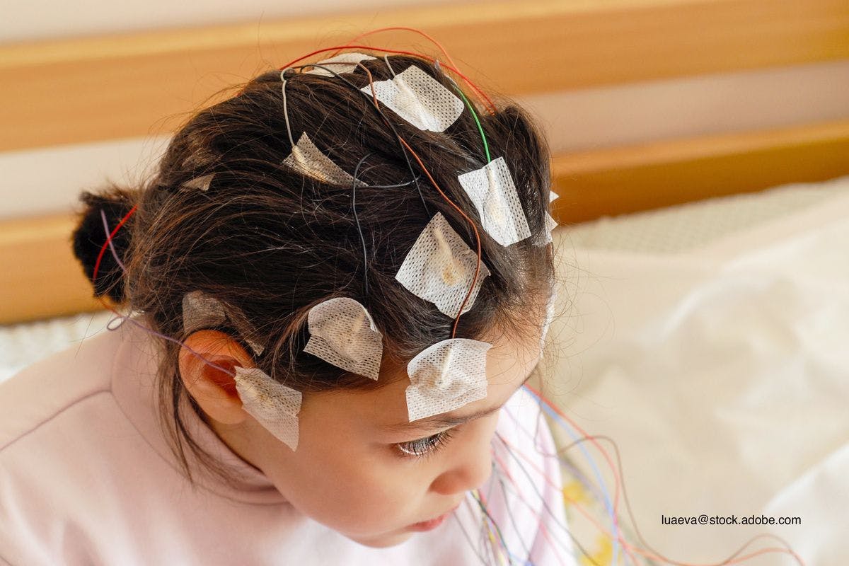 child with EEG monitoring