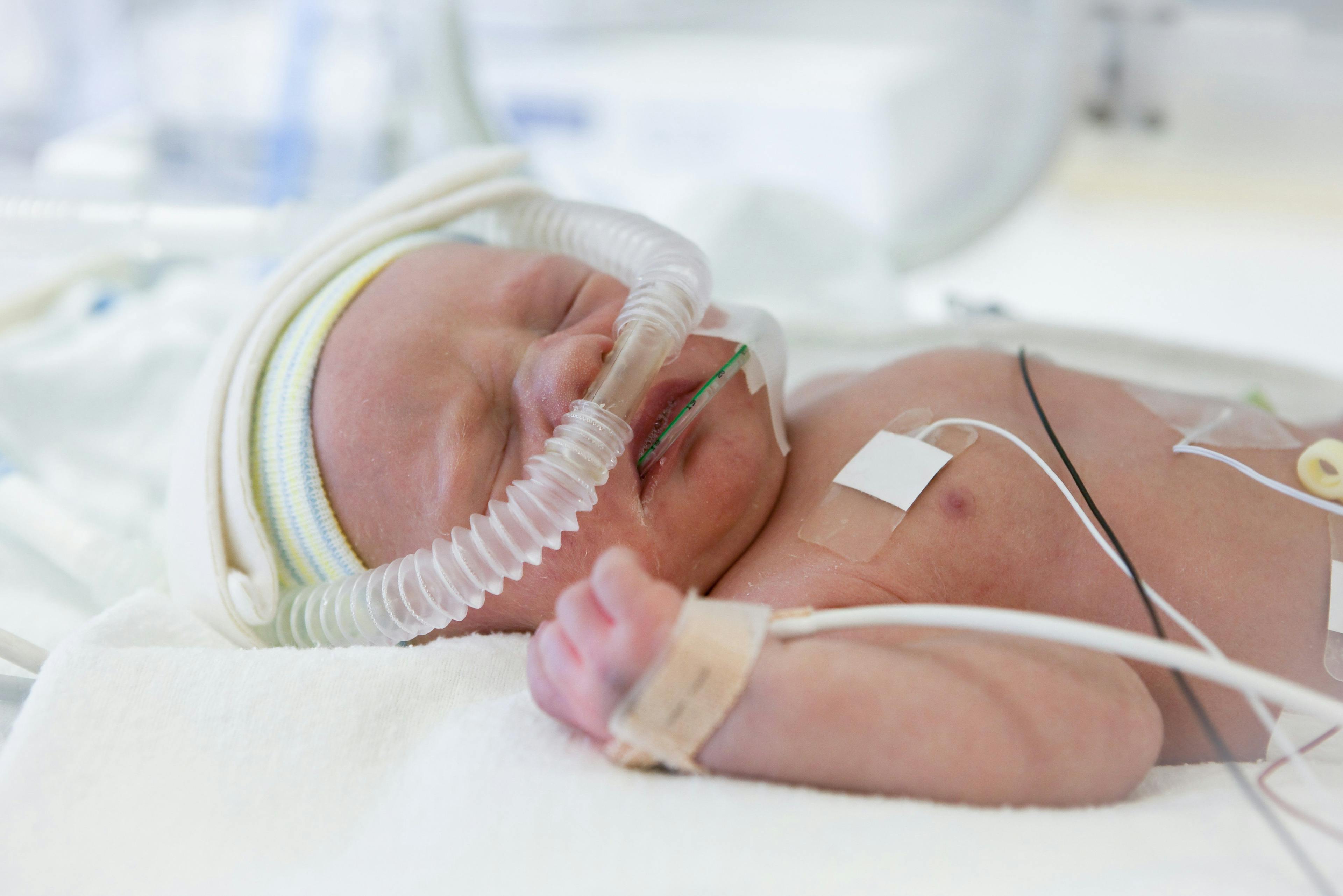 Preemie oxygenation updates lack specific guidance
